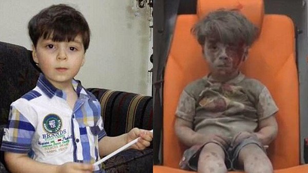 Image result for ‫شاهد.. كيف أصبح شكل الطفل السوري الشهير «عمران» بعد عام‬‎